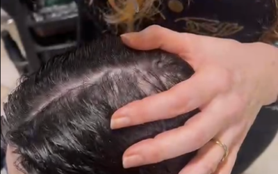 ✨Un nuovo respiro per la cute✨